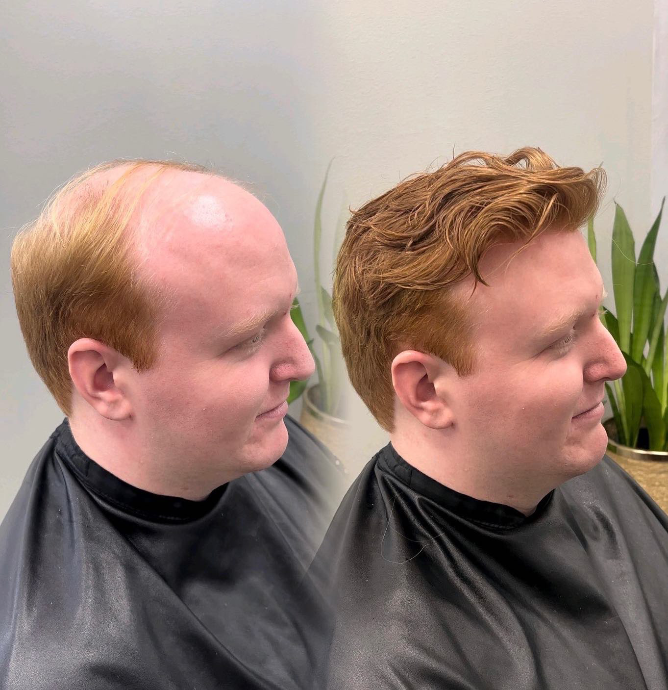 Hair system before and after, side profile