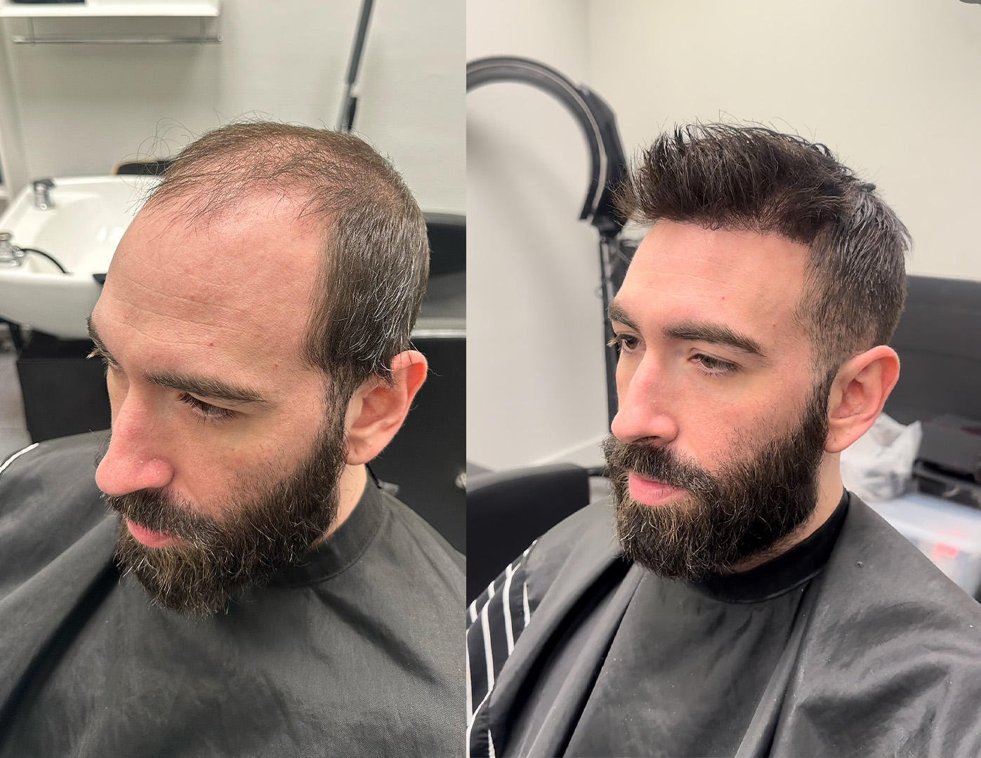 Before and after hair system result at JM Barber Co.